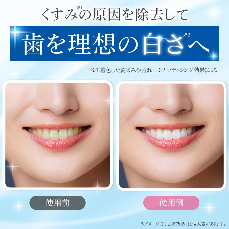 Teeth Bright Pack 歯 ホワイトニング シート 炭酸水素ナトリウム