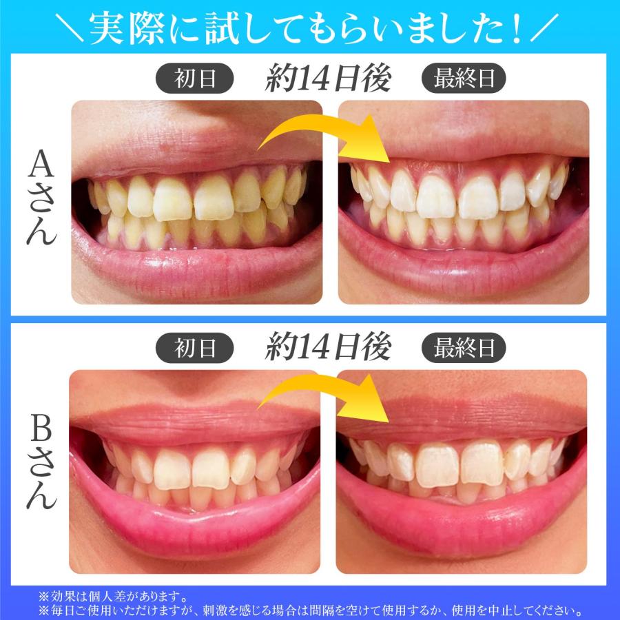 Teeth Bright Pack 歯 ホワイトニング シート 炭酸水素ナトリウム