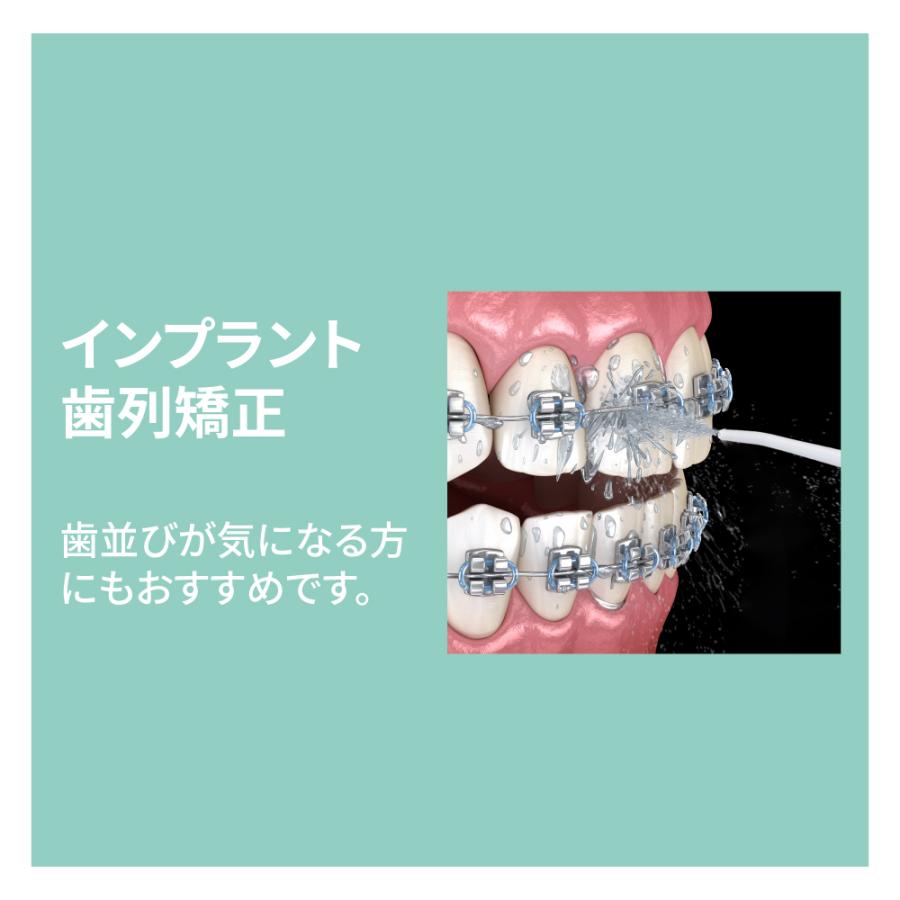 口腔洗浄器 ジェットウォッシャー マジカルトゥースウォッシャー 歯