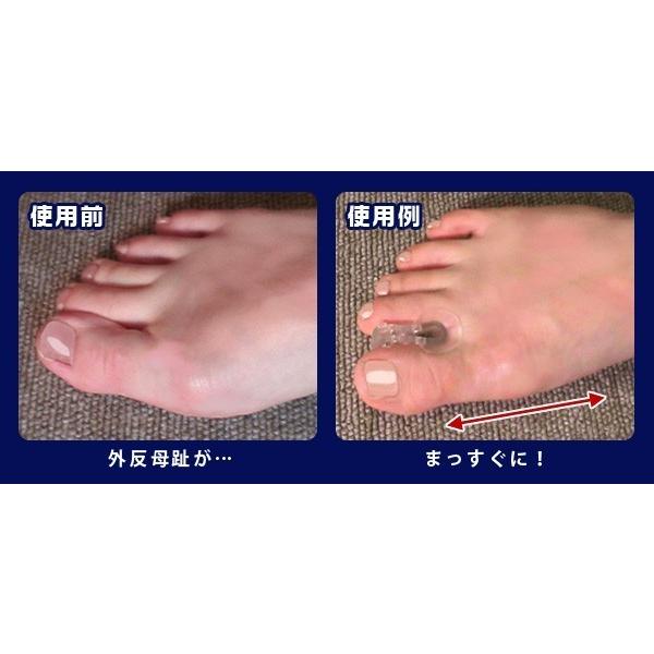 外反母趾フィットパッド（2個組） サポーター 予防 対策 保護 ガード