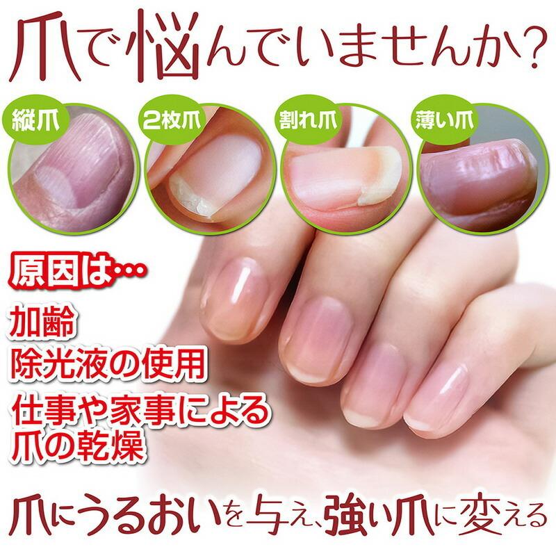 ネイル ケア オイル 爪保護液 30秒 今ならポイント10倍 サクラマチ Medi Guard 10ml 日本製 メディガード 速乾 Bl 032 福耳商店 通販 Yahoo ショッピング