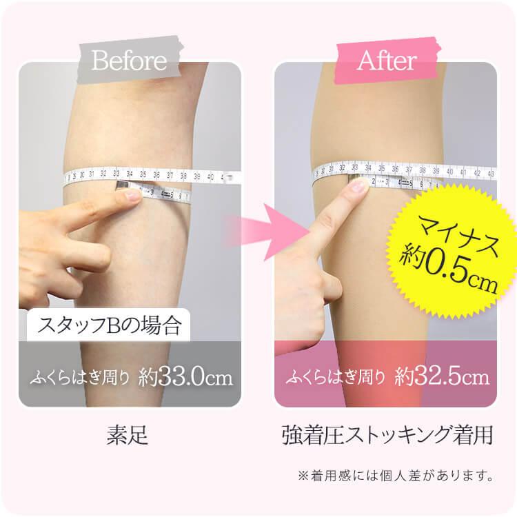 SUPER SUPPORT 着圧ストッキング スーパーサポート 強圧 140デニール 
