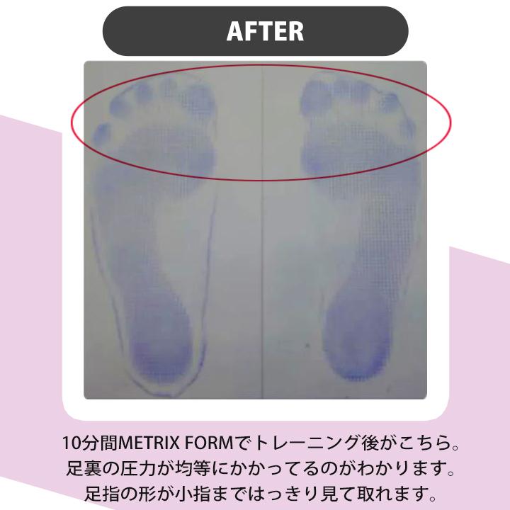 送料無料】 ボディメトリクス メトリクスフォーム (ミニ) 232BJXP003