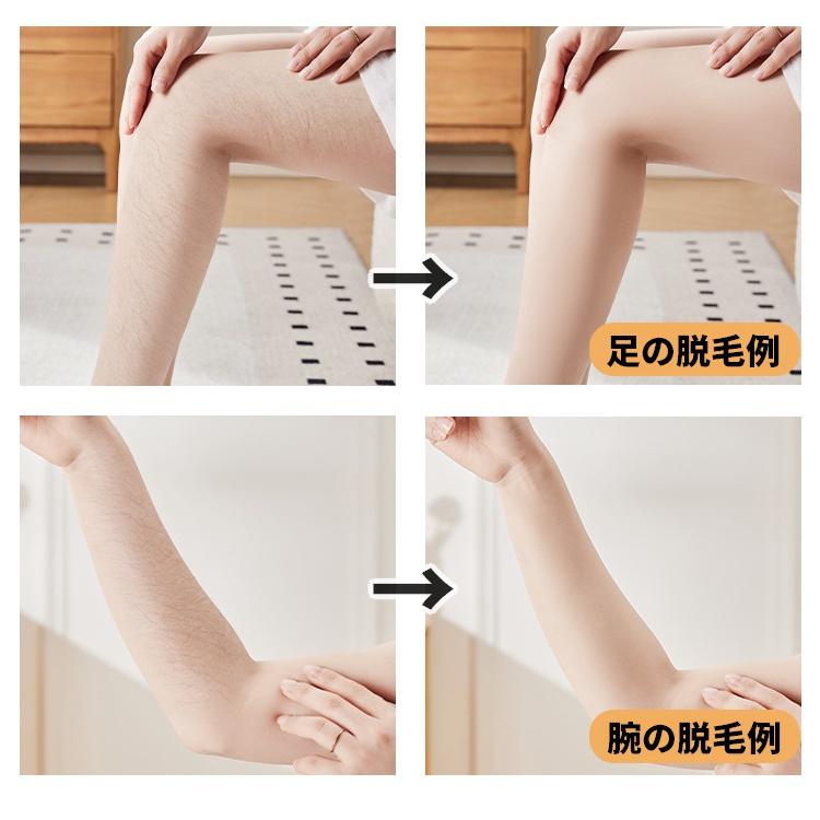 ナノガラス脱毛器 無痛脱毛 軽くこするだけ フタ付き ムダ毛 軽量 男女