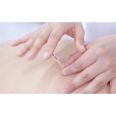 ふるさと納税 【ひかり整骨院】鍼灸ご利用回数券（6回） 兵庫県姫路市 