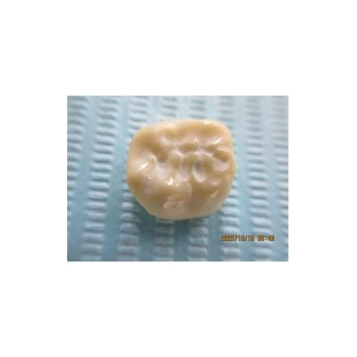 ふるさと納税 イベントやチケット等 東京都 東村山市 ジルコニアの1回治療(2年無料・7年有料保証付き) 1678768