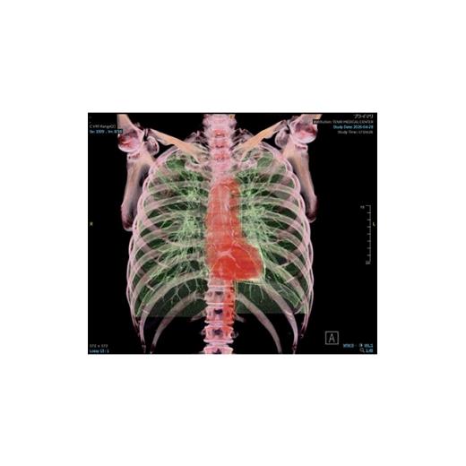 ふるさと納税 体験チケット 奈良県 天理市 「天理発 3D CT 画像健診」 1737492