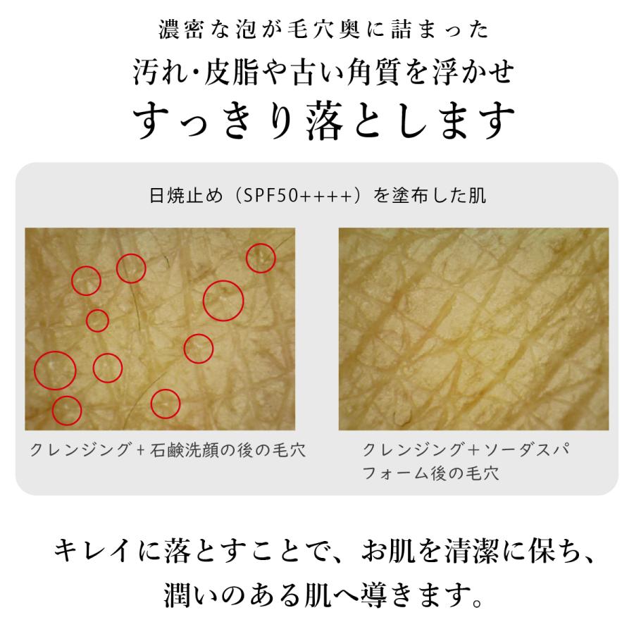 TANSAN MAGIC 炭酸パック ソーダスパフォーム フェイス用パック TANSAN MAGIC 炭酸パック ソーダスパフォーム フェイス用パック