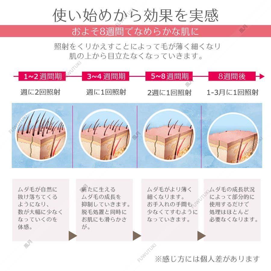 Ipl光脱毛器 Vio対応 レディース レーザー 永久脱毛 メンズ髭 光エステ 家庭用 99万発照射 5段階調整可能 光フラッシュ脱毛器 痛くない脱毛器 美肌 全身用 Fuwutuki Jd Tmy 01 A 風月 通販 Yahoo ショッピング