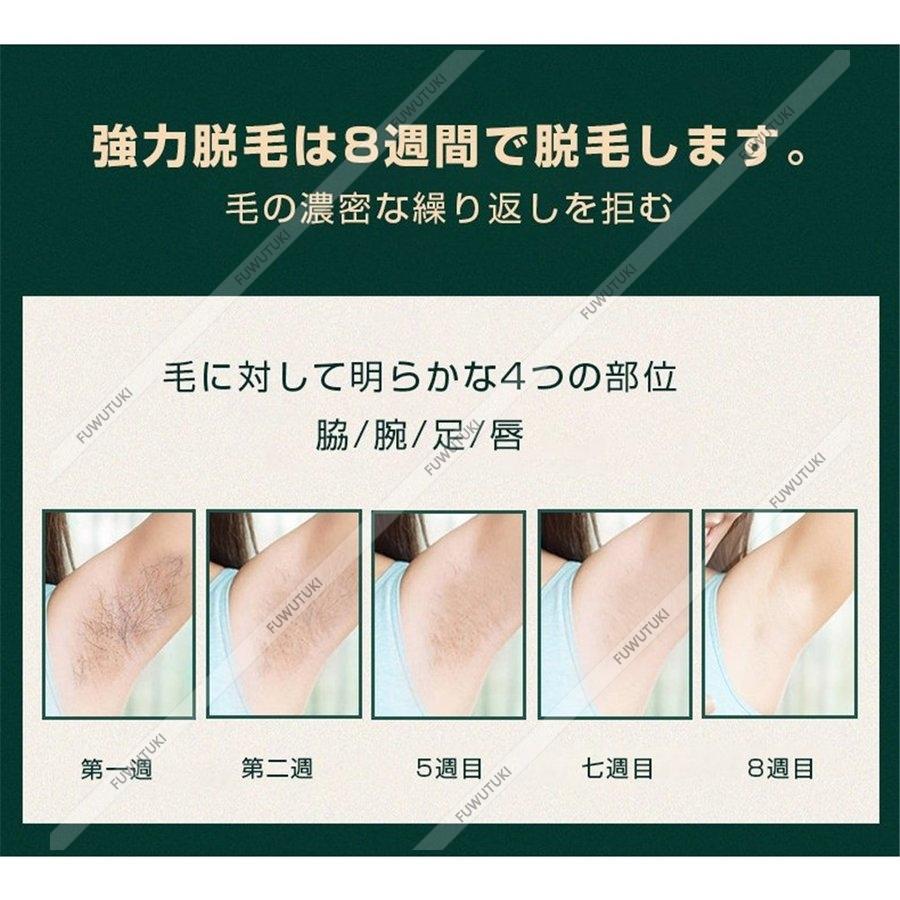 母の日 21 ギフト レーザー脱毛器 永久脱毛 Vio対応 女性 メンズ Ipl光脱毛器 家庭用 50万発照射 5段階レベル調節可能 で痛くない おしゃれ Fuwutuki Jd Tmy 07 風月 通販 Yahoo ショッピング