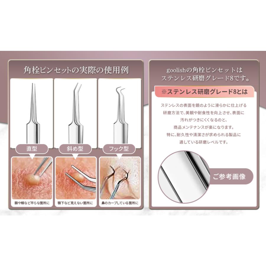ピンセット 精密 毛抜き 角栓 角栓取り 毛穴 小鼻 黒ずみ ニキビ