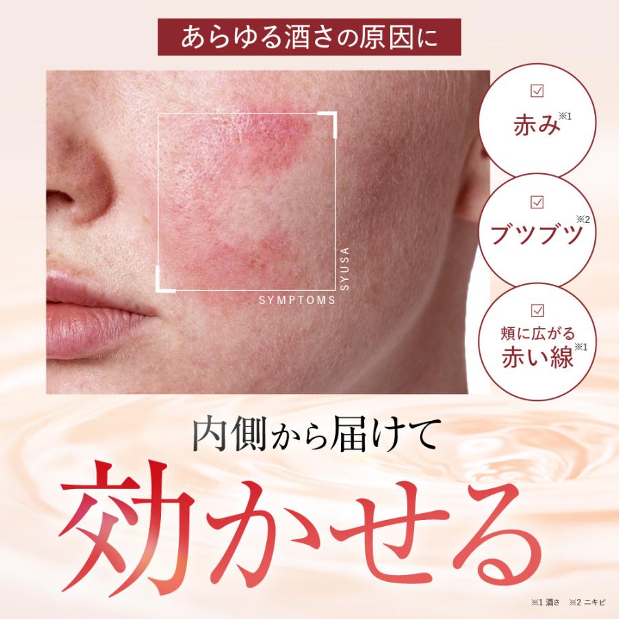SYUSA non シュサノン 180粒 3袋セット ジェネリック製薬 【第2類医薬品】シュサノン内服錠 酒さ 赤ら顔