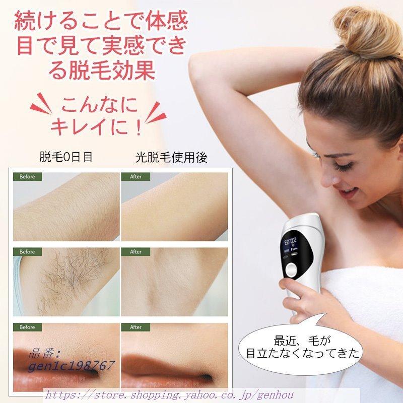 地上で リアル 息を切らして 足 脱毛 自宅 Katazukeya Jp