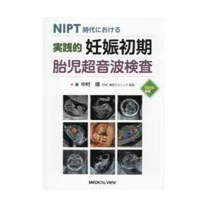 NIPT時代における 実践的 妊娠初期胎児超音波検査 NIPT時代における 実践的妊娠初期胎児超音波検査 | 中村 靖 |本 | 通販