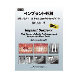 【裁断済み】インプラント外科　動画で理解！基本手技と自家骨移植のポイント インプラント外科 動画で理解!基本手技と自家骨移植のポイント