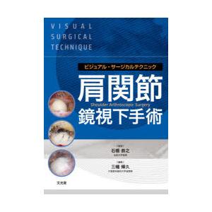 肩関節鏡視下手術 主な肩関節鏡手術 | 肩関節鏡