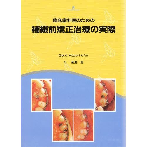 臨床歯科医のための補綴前矯正治療の実際 通販激安で人気