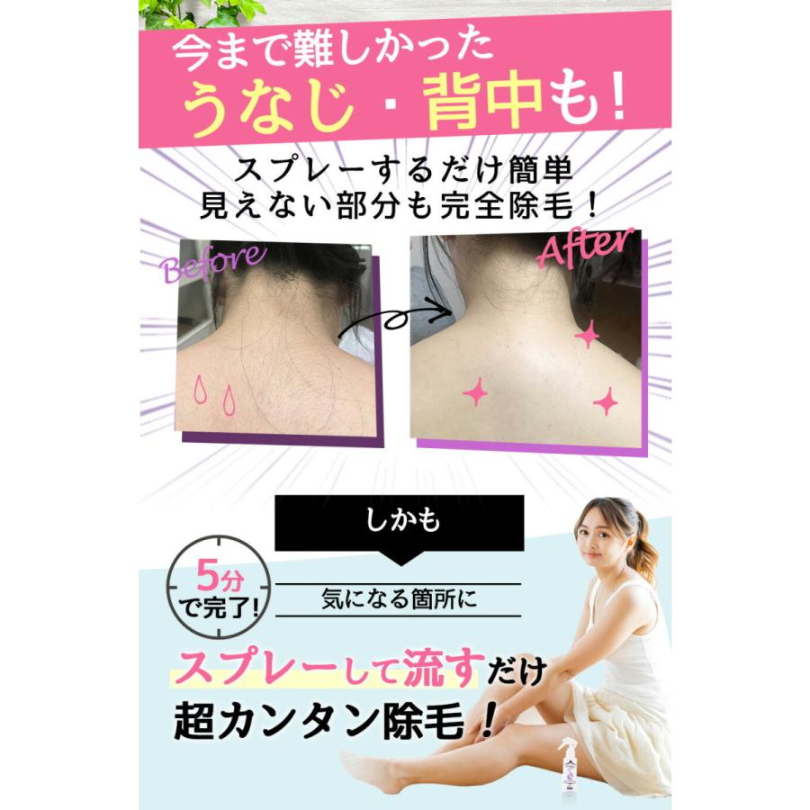 市場 エピアクア 肌ケア 除毛剤 ムダ毛 脱毛 ボディケア 美肌