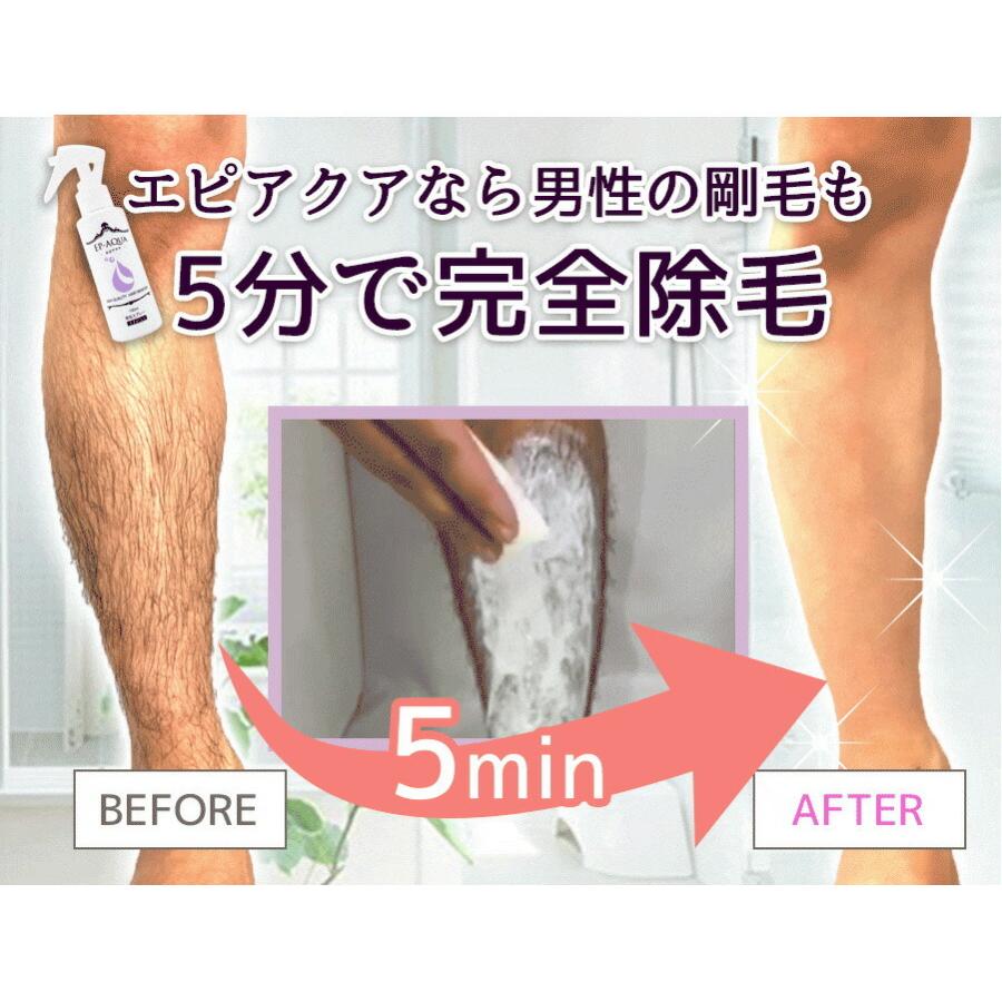 エピアクア 薬用除毛スプレー 完全除毛 医薬部外品 日本製 除毛 美肌