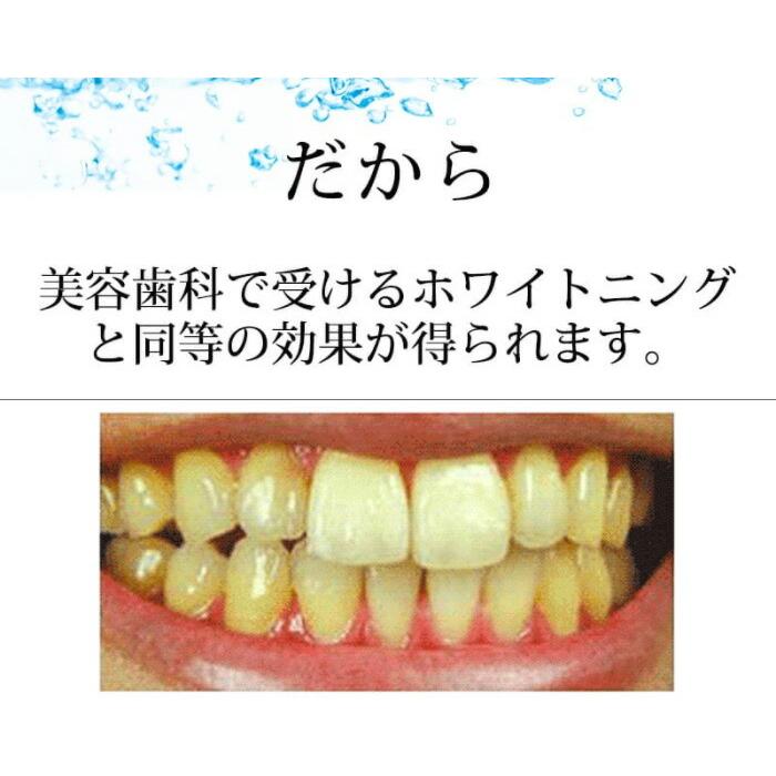 お買得3点セット 薬用パールホワイトプロ EXプラス 30ml ＋ プロ
