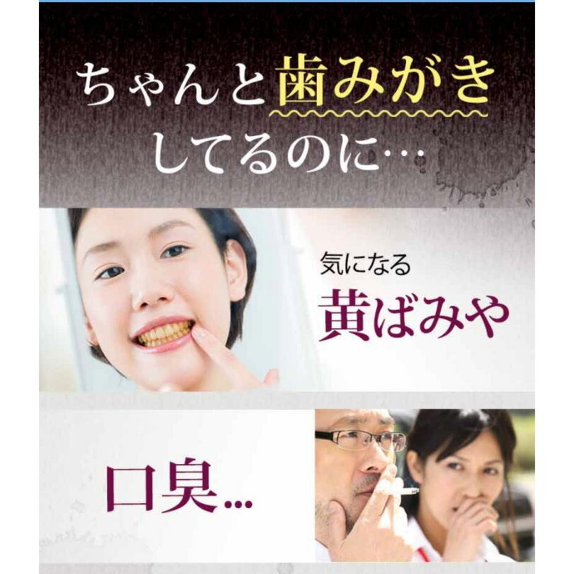薬用パールホワイトプロ EXプラス 30ml＋プロシャイン120g 黄ばみ ヤニ