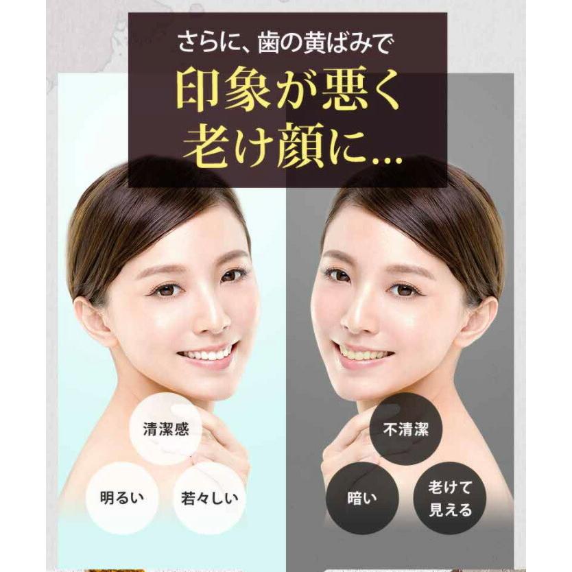 お買得3点セット 薬用パールホワイトプロ EXプラス 30ml 2本 ＋ プロ