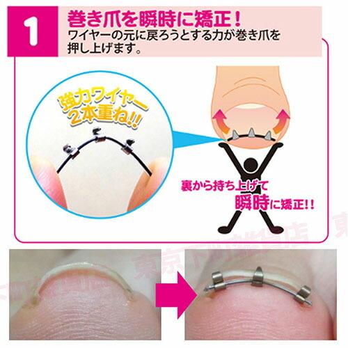 正規品 1個単品 まきづめリフト 4個クリップ 巻き爪 巻きづめ 矯正