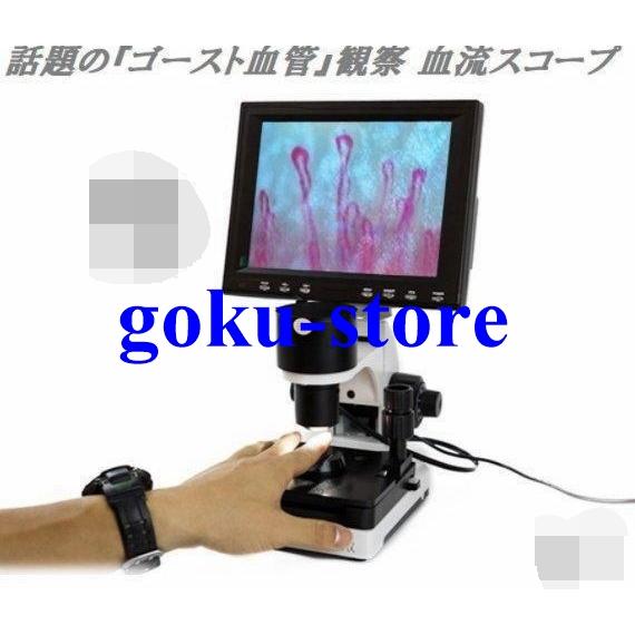 観察 血流スコープ◆毛細血管 顕微鏡 880+600倍+8インチ画面をクリア（Yahoo!・悟空）