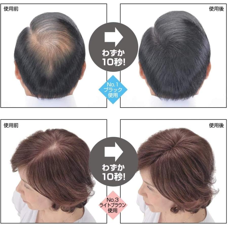 スーパーミリオンヘアー 20g No.11 グレー 薄毛 抜け毛 円形脱毛症 白髪 対策 増毛パウダー 髪 頭皮 分け目 生え際用 薄毛隠し 白髪隠し |  | 02