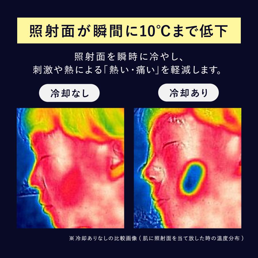Re・De リデ 脱毛器 vio対応 冷感 冷却 ハイパワー 4段階 家庭用 UVスタンド付き DuoClear IPL 光美容器 ホワイト 白 BR01Aの画像