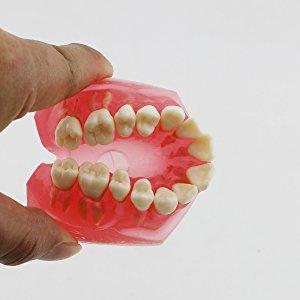 Romantic桜 歯列模型 上下顎180度開閉式 義歯モデル 歯茎が柔らかい 歯磨き 指導 研究 説明用 標準教学模型 脱着可能｜goodzero｜08