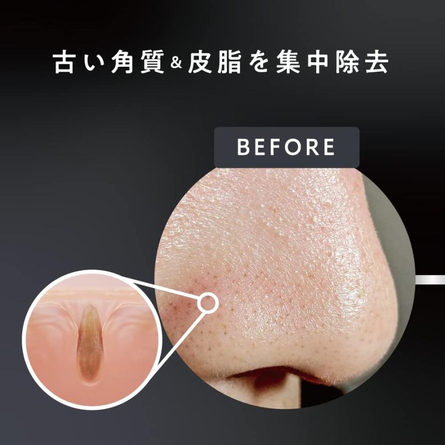 NAKUNA-RE（ナクナーレ） 【公式｜訳あり】JUSO KURO PORE CLEANSING