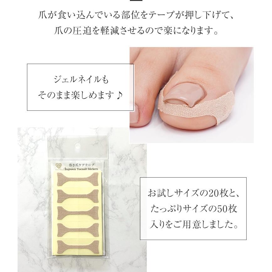 gracegarden（グレースガーデン） 貼るだけで巻き爪のつらさを楽に