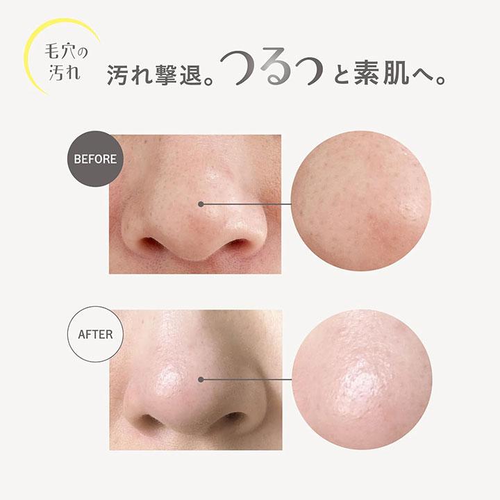 MD カプセルスクラブ クレンジングオイル V 150ml 1個 角栓溶解 メイク
