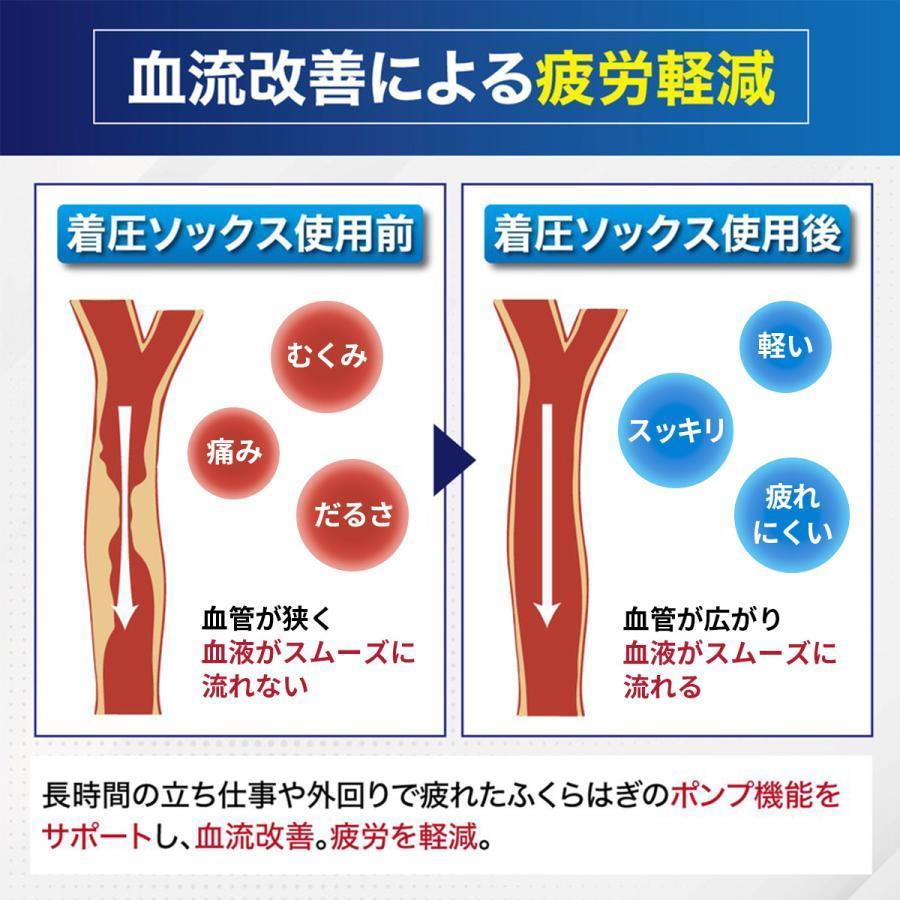 着圧ソックス メンズ  弾性ストッキング ふくらはぎサポーター 寝るとき 靴下 むくみ 加圧ソックス 男性用｜greenpeace-st｜08