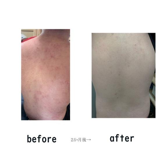 送料無料　酵素マジック　５０ｍｌ　スプレー容器入り |  | 06