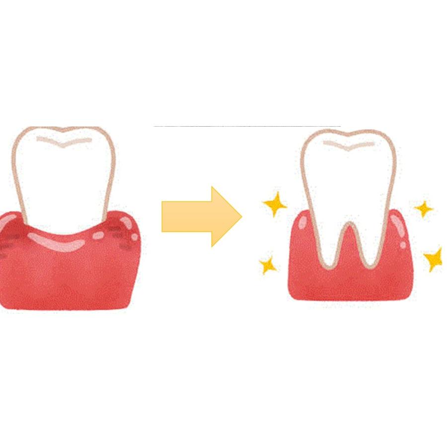 歯周病菌３０秒で100％殺菌　歯石分解　完全無添加マコモはみがきジェル　虫歯の原因菌分解　１日中ツルツル続く　 |  | 01