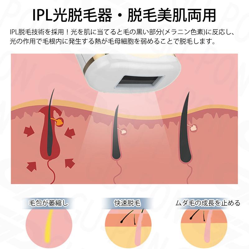脱毛器 Vio対応 今だけ更に100円クーポン メンズ 子供 女性 光脱毛 家庭用 光脱毛器 Vio 光脱毛用サングラス Ipl光脱毛器 口コミ 全身用 冷感 即納 1年保証 Ltmy000db1159 グーポンショップ 通販 Yahoo ショッピング
