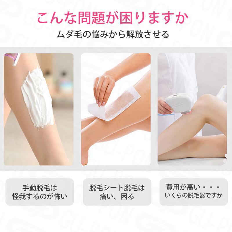 Vio シェーバー 女性 メンズ 電動シェーバー 年始6 Offクーポン進呈 替刃 Vio 電気シェーバー ムダ毛処理 眉毛 レディースシェーバー 顔 脇 充電 顔用 Usb充電 Ltmy000db グーポンショップ 通販 Yahoo ショッピング