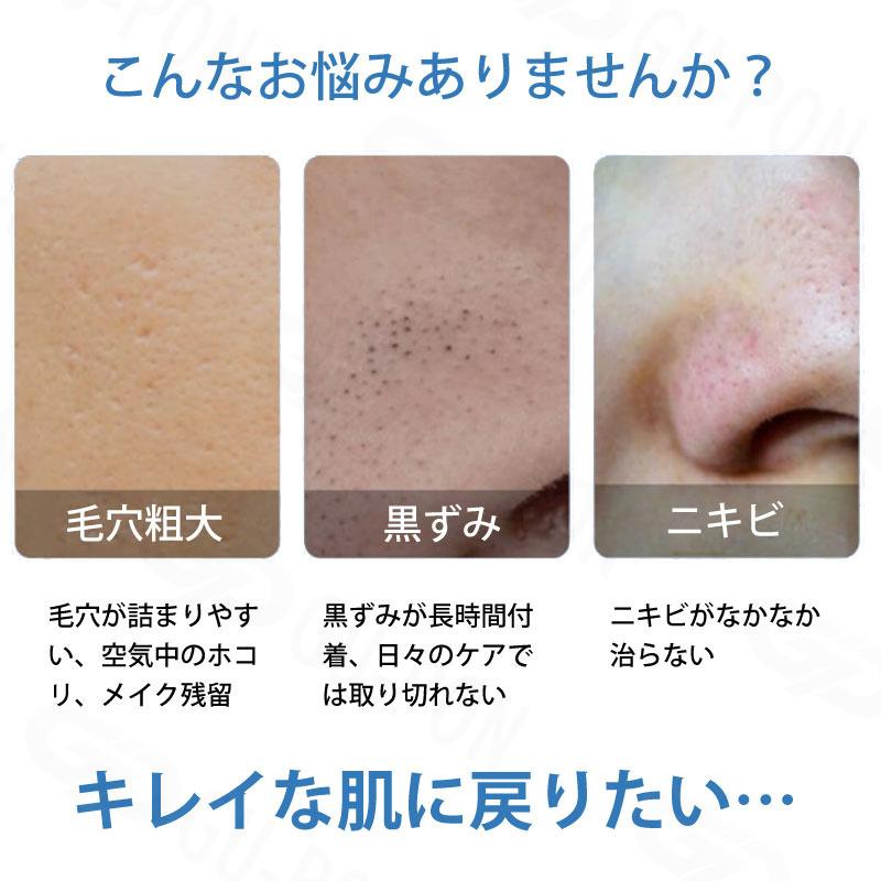 毛穴吸引器 毛穴ケア 口コミ 毛穴ケア いま注目の美容アイテム メンズ 角栓除去 美顔器 黒ずみ 鼻 イチゴ鼻吸引 クレンジング Ems 効果 毛穴 毛穴クリーン美肌 Q グーポンショップ 通販 Yahoo ショッピング