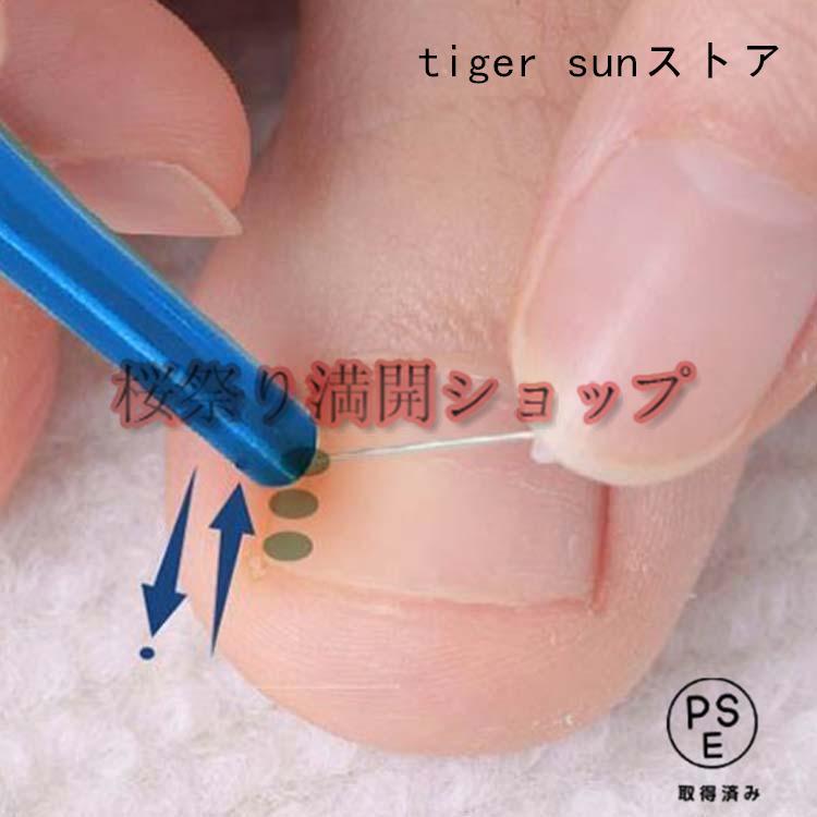 巻き爪 ワイヤーガード 矯正 親指 足 巻きづめ 巻き爪ワイヤーガード 4