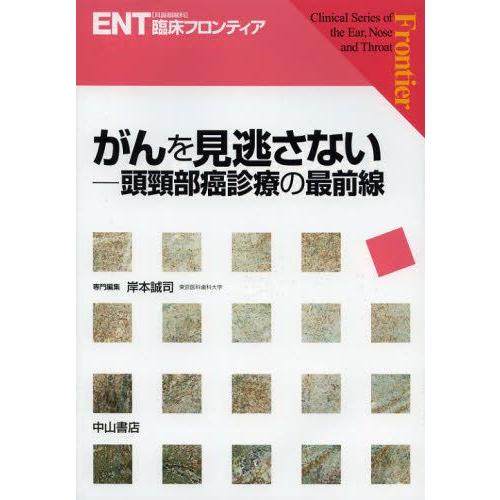 がんを見逃さない 頭頸部癌診療の最前線