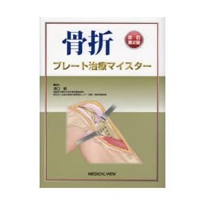 骨折プレート治療マイスター 骨折プレート治療マイスター : ぐるぐる王国 ヤフー店 - 通販 - Yahoo
