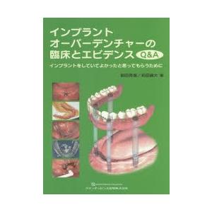 【裁断済み】インプラントオーバーデンチャーの臨床とエビデンス Q&A インプラントオーバーデンチャーの臨床とエビデンスQ＆A インプラント