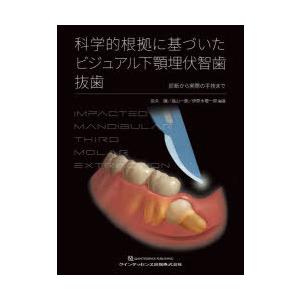 【裁断済み】科学的根拠に基づいたビジュアル下顎埋伏智歯抜歯 科学的根拠に基づいたビジュアル下顎埋伏智歯抜歯 診断から実際の手技