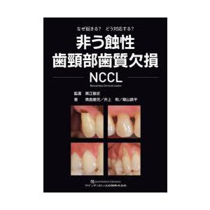非う蝕性歯頸部歯質欠損NCCL なぜ起きる?どう対応する? : ぐるぐる王国