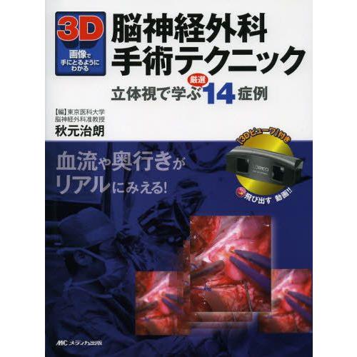 3D画像で手にとるようにわかる脳神経外科手術テクニック 血流や奥行きがリアルにみえる!立体視で学ぶ厳選14症例｜guruguru