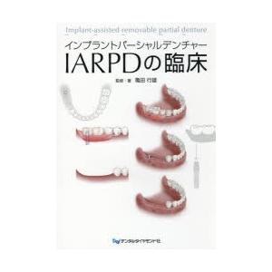 パーシャルデンチャーの基本を押さえたIOD・IARPDの臨床／医歯薬出版