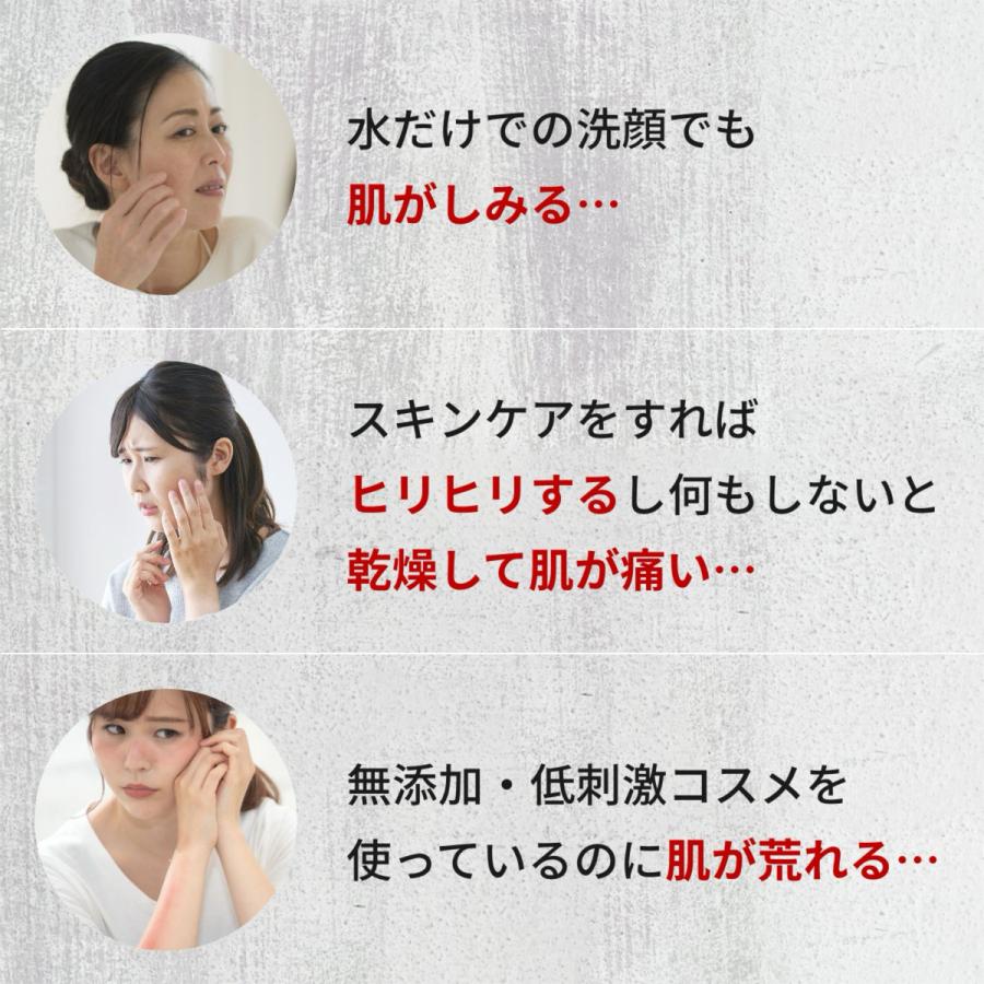 敏感肌 高保湿 低刺激 オールインワンゲル セラミド べたつかない ジェル 保湿ジェル 保湿クリーム 乾燥肌 ニキビケア 毛穴ケア 黒ずみ 脂漏性皮膚炎 湿疹 酒さ | 肌〇 | 03