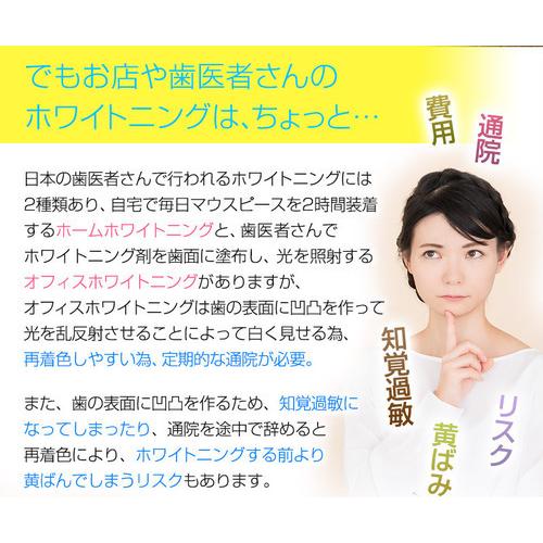 ホワイトニングキット シャインスマイル ホワイトニングキット Shine Smile Whitening Kit 歯